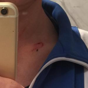 taste of blood...（Demo）