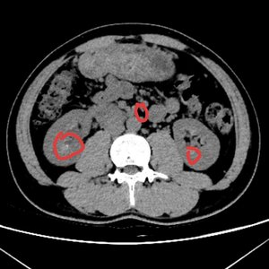 卡斯特梅的雨季