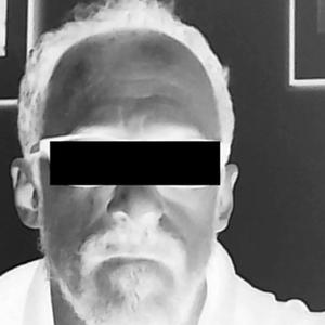 I Fell for your Red Eyes Straining in Xenon Light