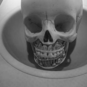 Corrosion