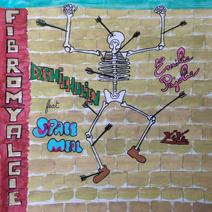 Fibromyalgie