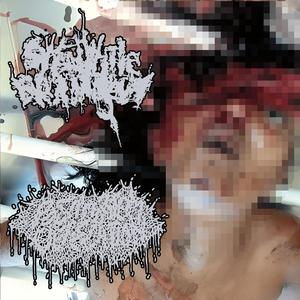 Hydrofluoric Corrosive Stomach Injury