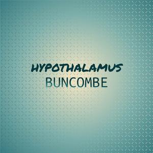 Beautiful Acquisition