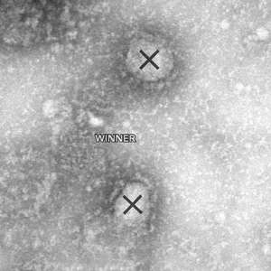 Winner