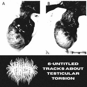 6-Untitled Tracks about Testicular Torsion