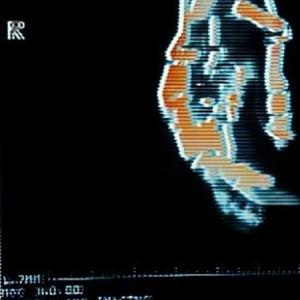 Lock Jaw (feat. Drear)