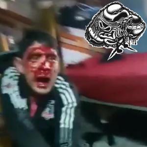 BRUTALIZED BY CHILEAN GANG MEMBERS