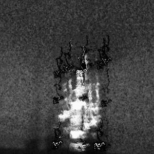 PARALIŻE/PRAWDZIWY AUTYZM JEST TUTAJ