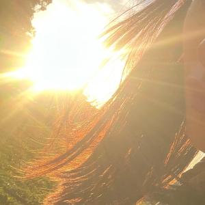 Sunburn