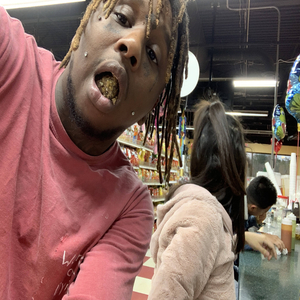 FBGM