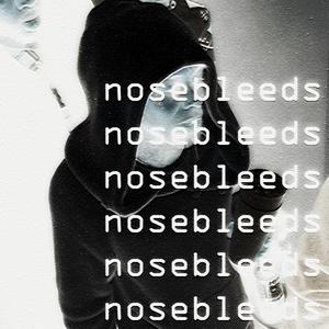 nosebleeds
