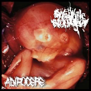 Gastroduodenal Arterial Aneurysms