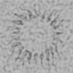 Distimia