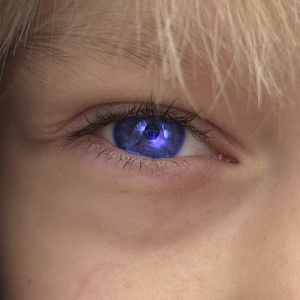 Синеглазый