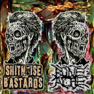 Hemolytic Splenomegaly