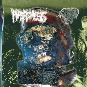 Fetal Deformity - Foaming Process Adipocere