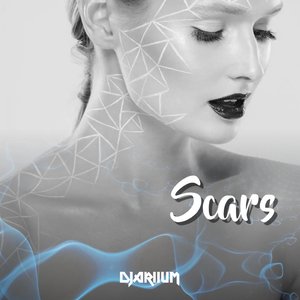 Scars