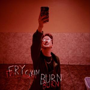 Fry Skin Burn