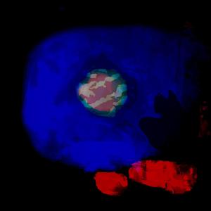 Life Choice A (Turmoil)