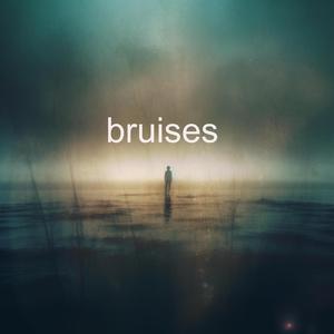 Bruises