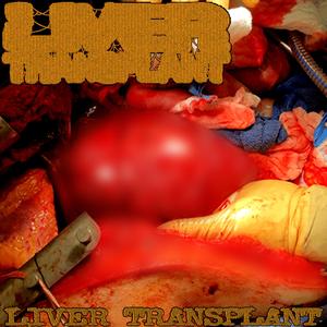 Reperfusion of the Liver