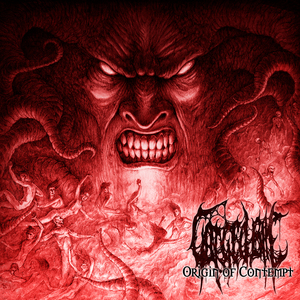 Necrotizing Fasciitis