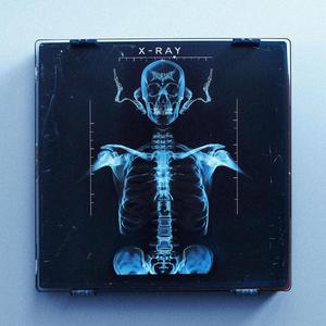 X-RAY