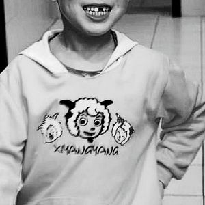 Dolly Zoom（希区柯克变焦）