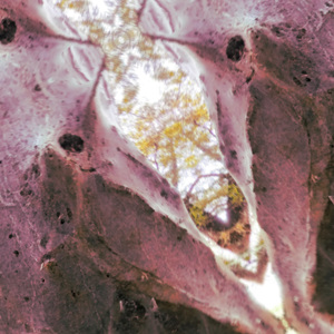 Immune Activation Frequencies