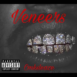 Veneers