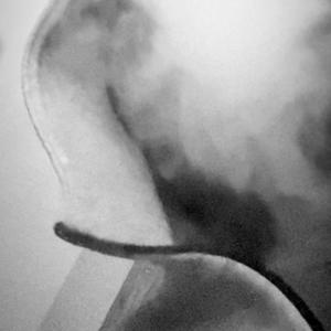 wym (feat. 6klled & kidracks)