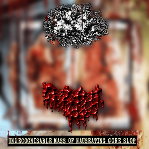 MxTxAx Pneumonoultramicroscopicsilicovolcanoconiosis