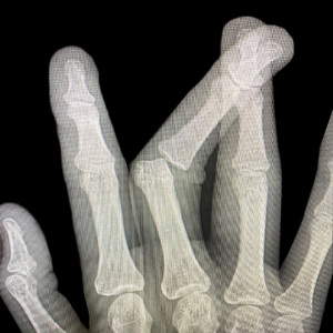 abcdefu（Joy Boy remix）