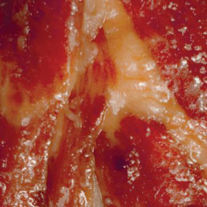 多吃蔬果  Vegetables