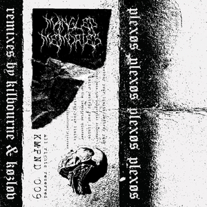 Staring At The Picture (KØZLØV Remix)