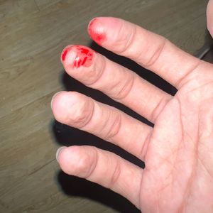 migrate(prod.KLevee)