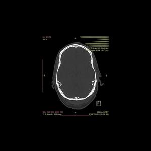 Where Did I Put My Brain