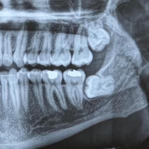 Change For You (feat. hollow.soul)