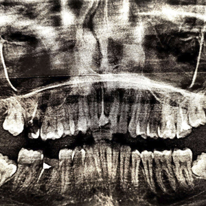 всё ещё жив