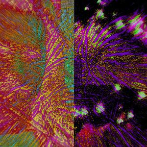 never let an expert dig up fur bones that lay wormly by free pallets or let everyone be struck by lightning, the neither is the farther