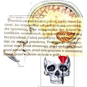 LOBOTOMIA NA NFZ (Psychoza)