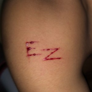 E