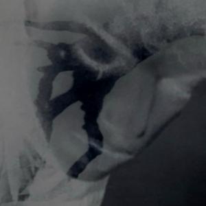 eyewater