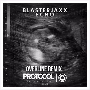 Echo (OverLine Remix)