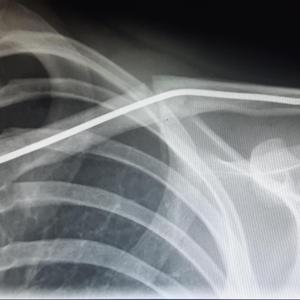 Collarbone (feat. ADEBAYO)