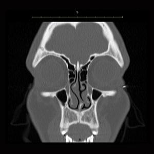 The Wonder of Wondering