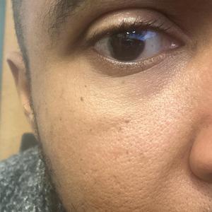 The world is crazy, so I wish I could call my mom (or "Since You've Been Gone") (Live)