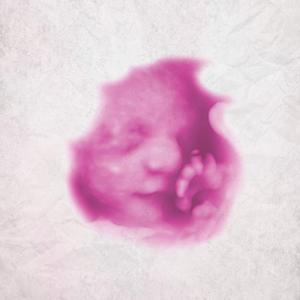 To My Unborn