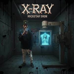 X-RAY