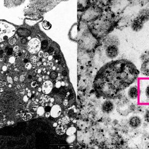 Омикрон prod by treezyswagga